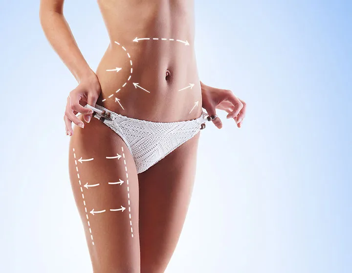 Lipo 360